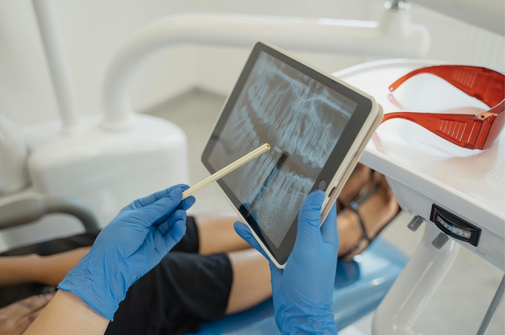 Dental implants showing teeth